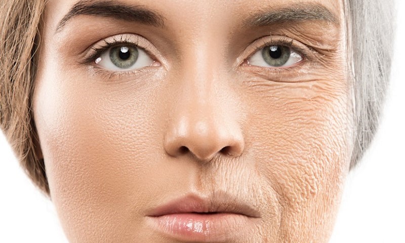 بهترین روش سفت کردن پوست صورت