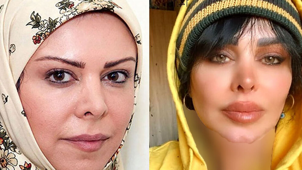 ۶ بازیگر زن ایرانی که ناگهان تغییر قیافه داده‌اند