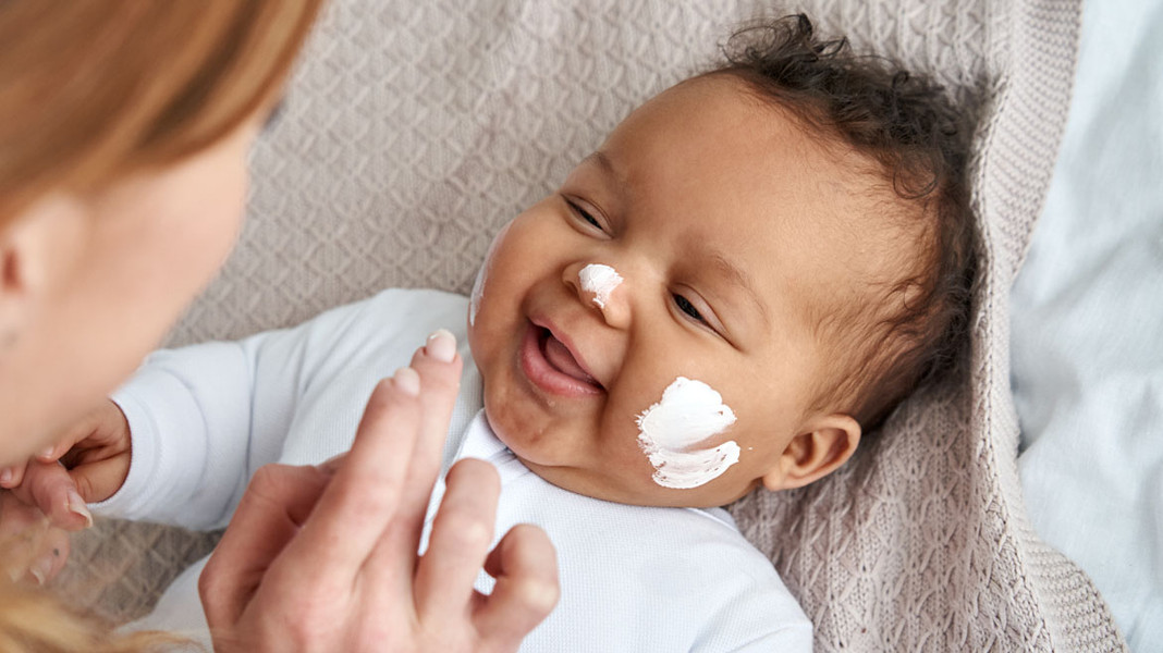 پوست نوزادان و کودکان به دلیل حساس و لطیف بودن به مراقبت بیشتری نیاز دارد