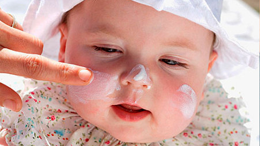 جلوگیری از خشکی پوست کودکان
